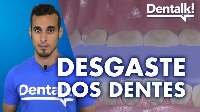 Desgaste dos dentes, novo capítulo de Dentalk!